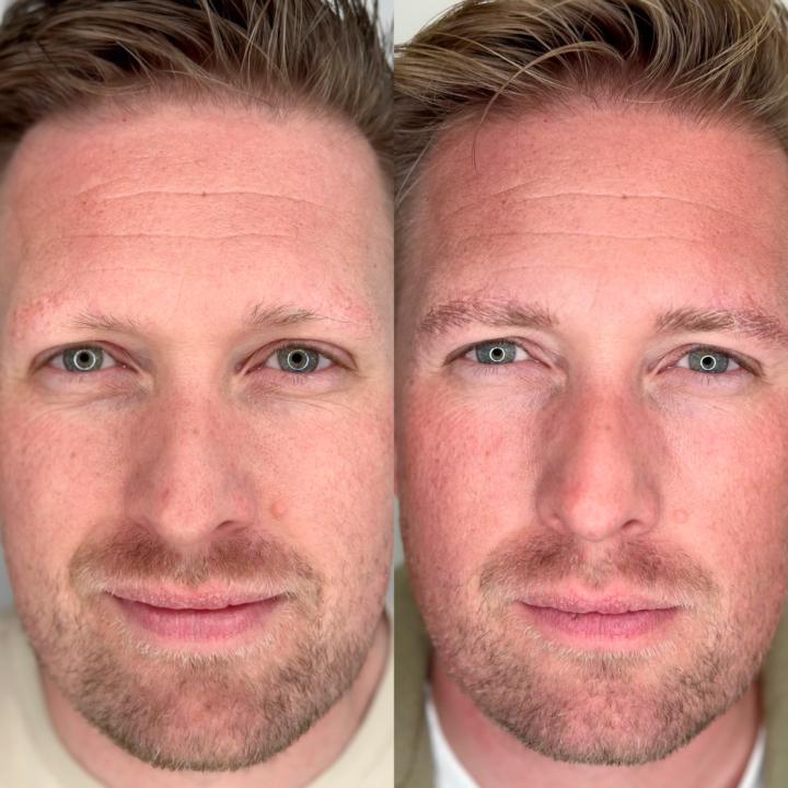 MAN BROW RESULTS 💥