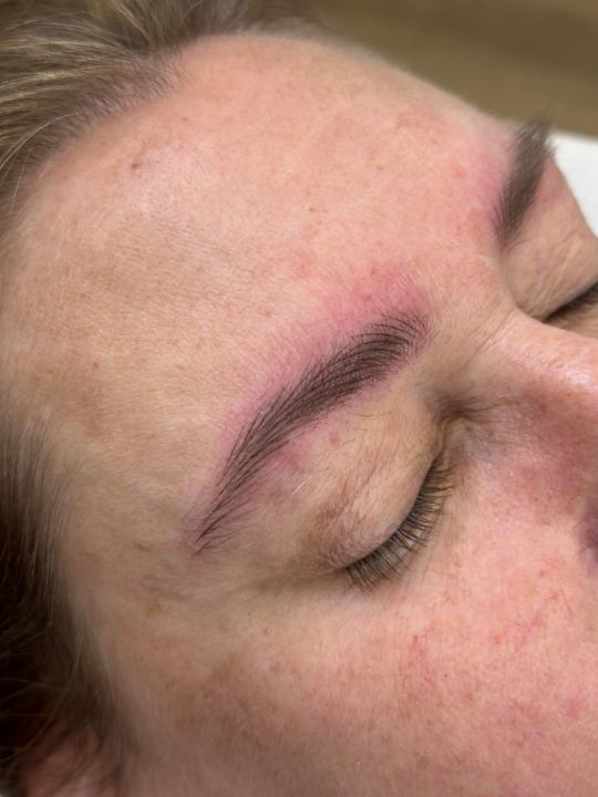 Client Log: Red, Mature Skin (55)