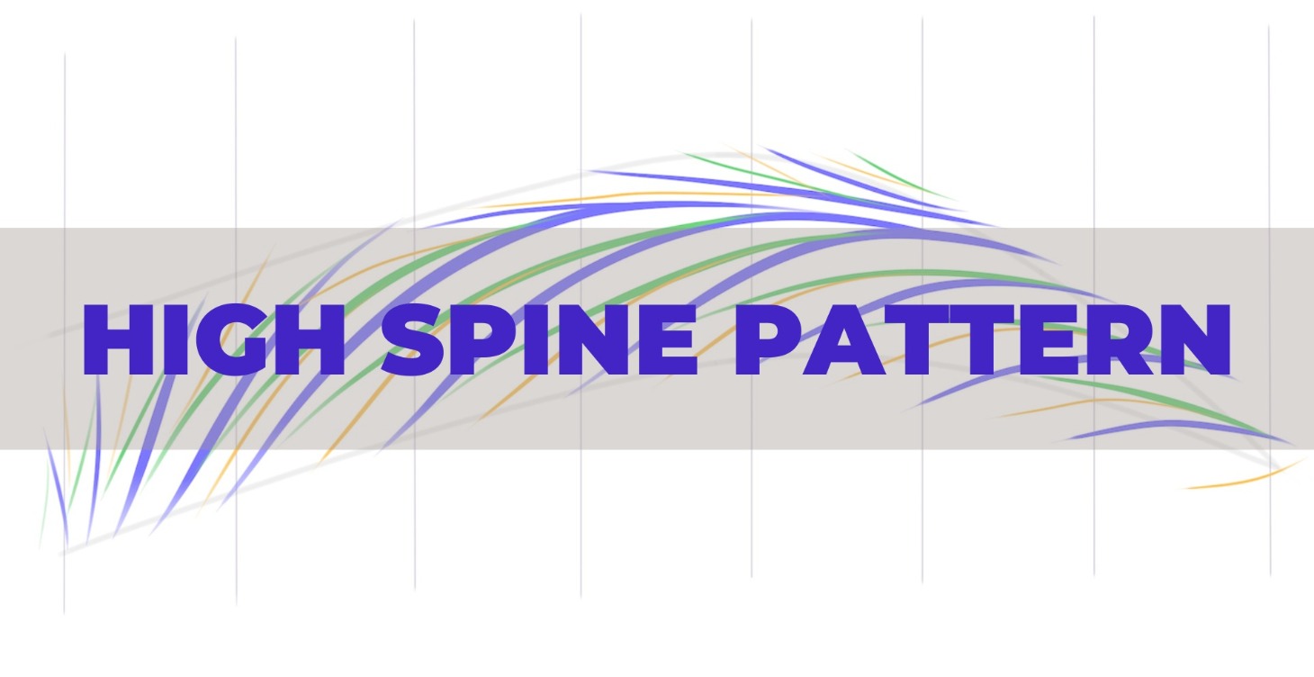 High Spine Pattern
