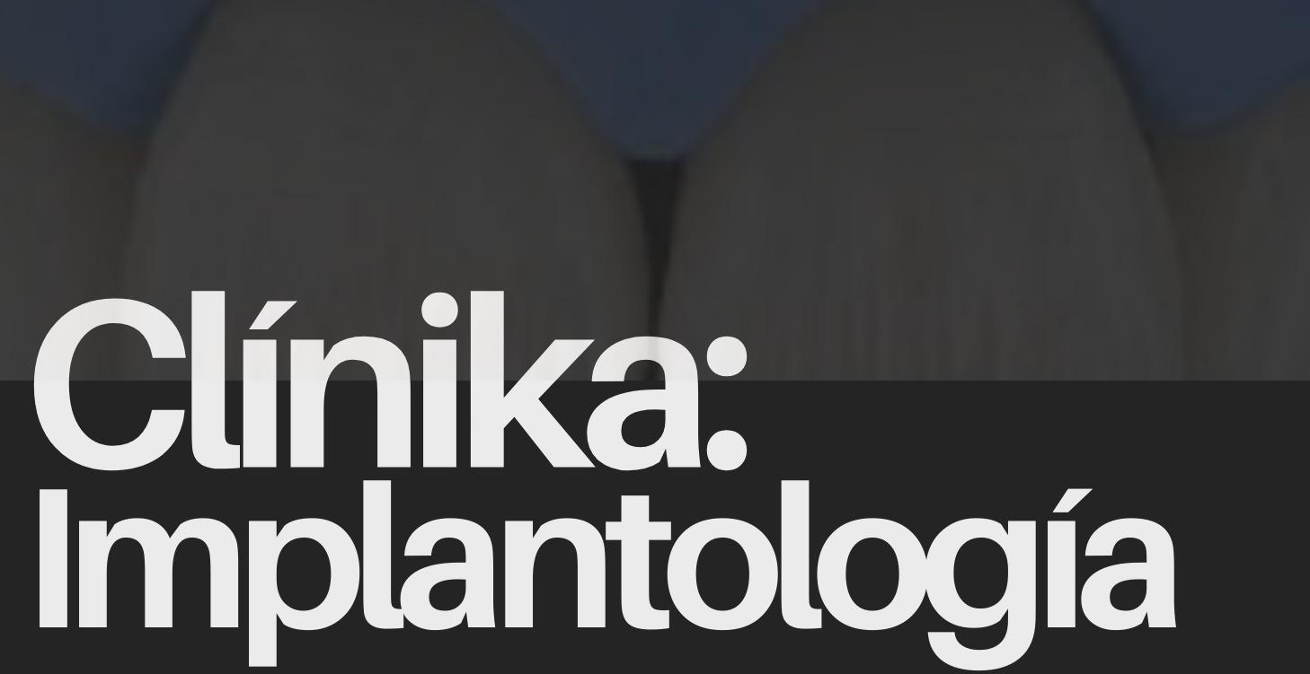 Clínika: Implantología