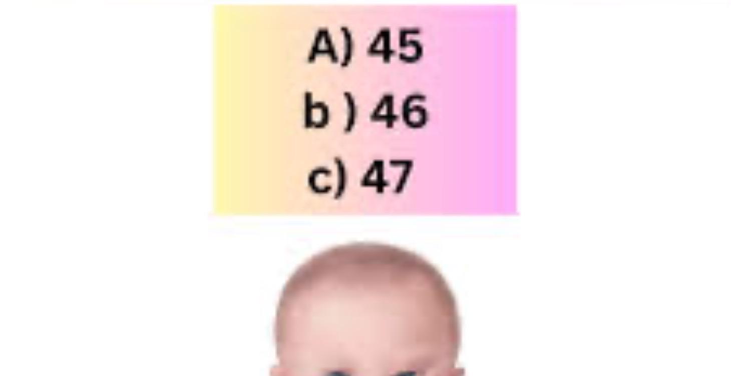 Down Syndrome/Trisomy21