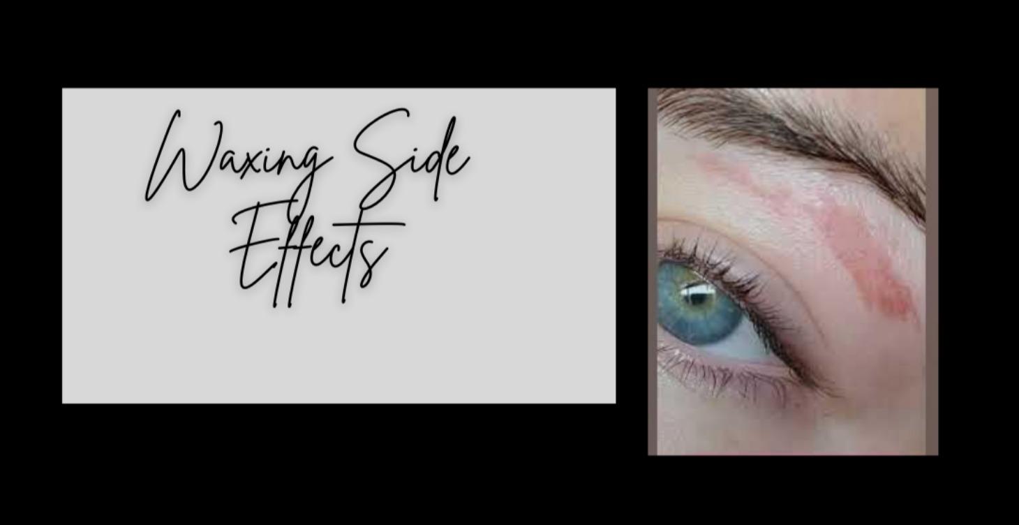 Waxing Side Effects