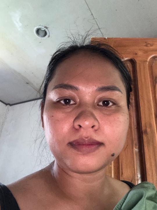 Merl Madal