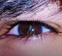 Plattio Maseratti Carlo