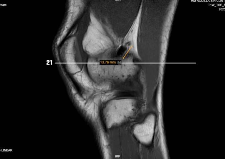 https://www.cmrad.com/cases/1711855257