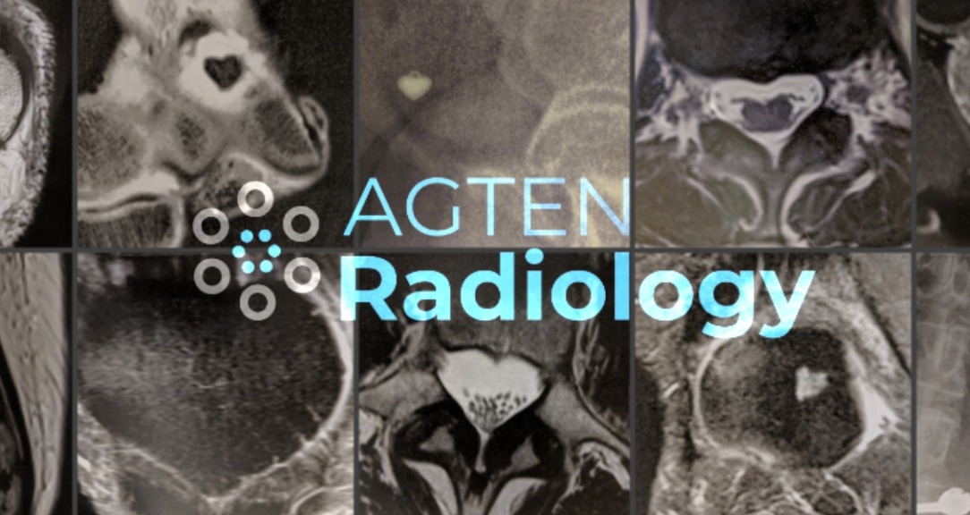 Mri hip replacement and complications · MSK Radiology School