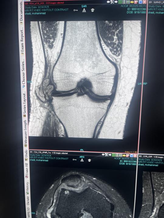 Knee MRI