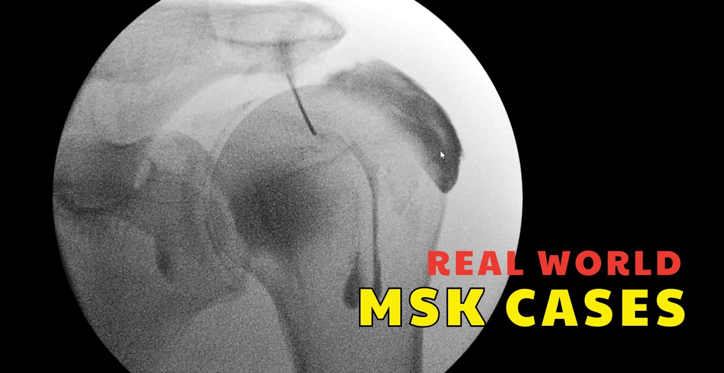 Real-World MSK Cases