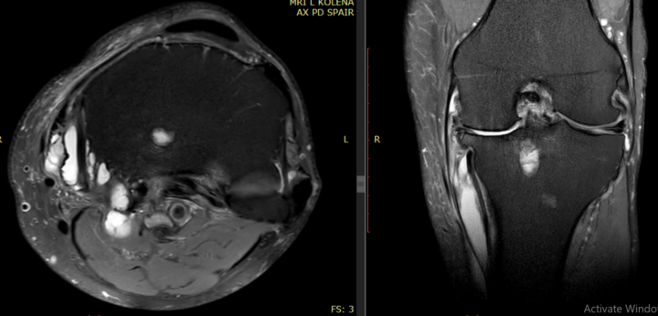 Male 75yo - pain, no trauma