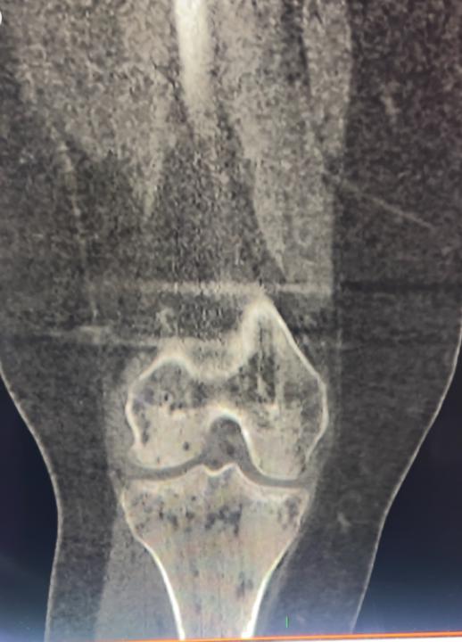 Differentials?