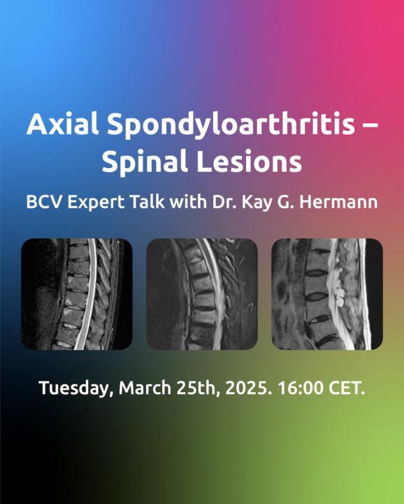 FREE Lecture and Case Reading Session on Axial Spondyloarthritis