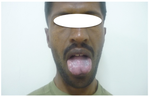 Quiz sémiologie endocrine