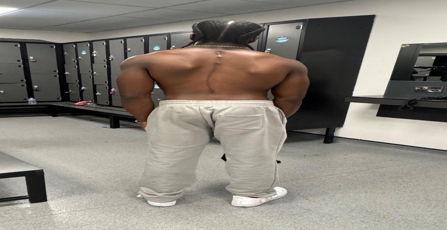 Phase 4 - (BONUS) Dealing With Scoliosis