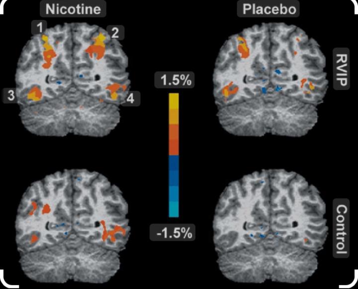 How Smoking Changes Your Brain
