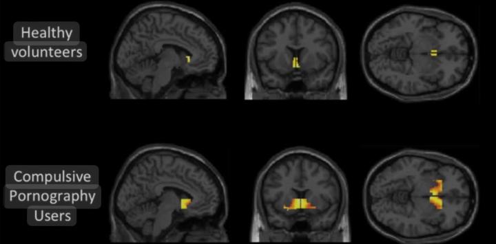 How Porn Changes Your Brain