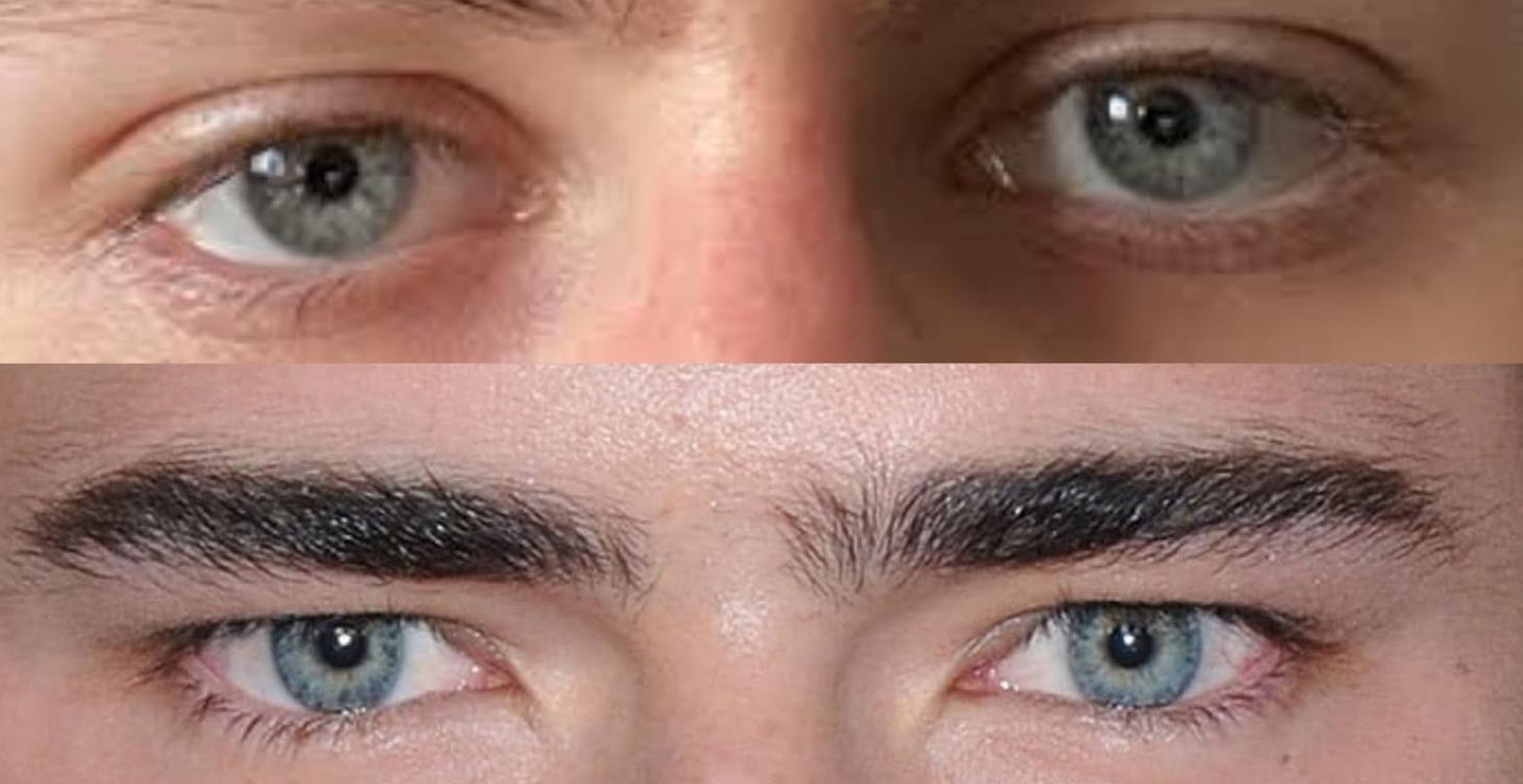 Hunter Eyes & Canthal tilt