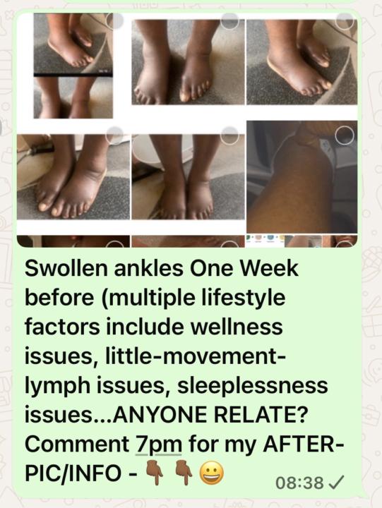 Anyone Else Dealing With Swollen Ankles, Poor Sleep & Heavy Legs?