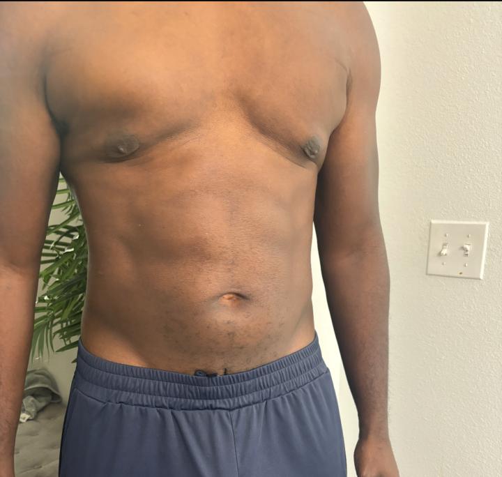 GLP-1 Talk!  Ask my Playbook!