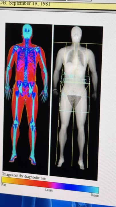 Free DEXA scan at G.O.A.T. Athletic Spas