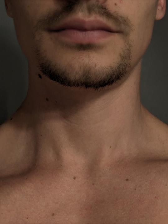 Hugo Denis