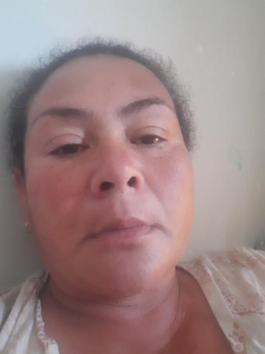 Aba Anderson