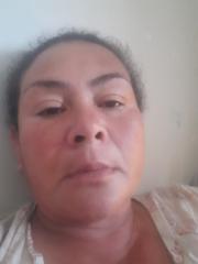 Aba Anderson