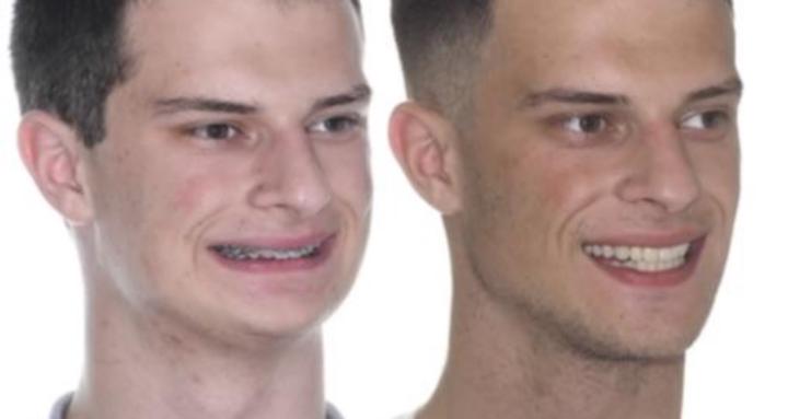 Maxillofacial Labs