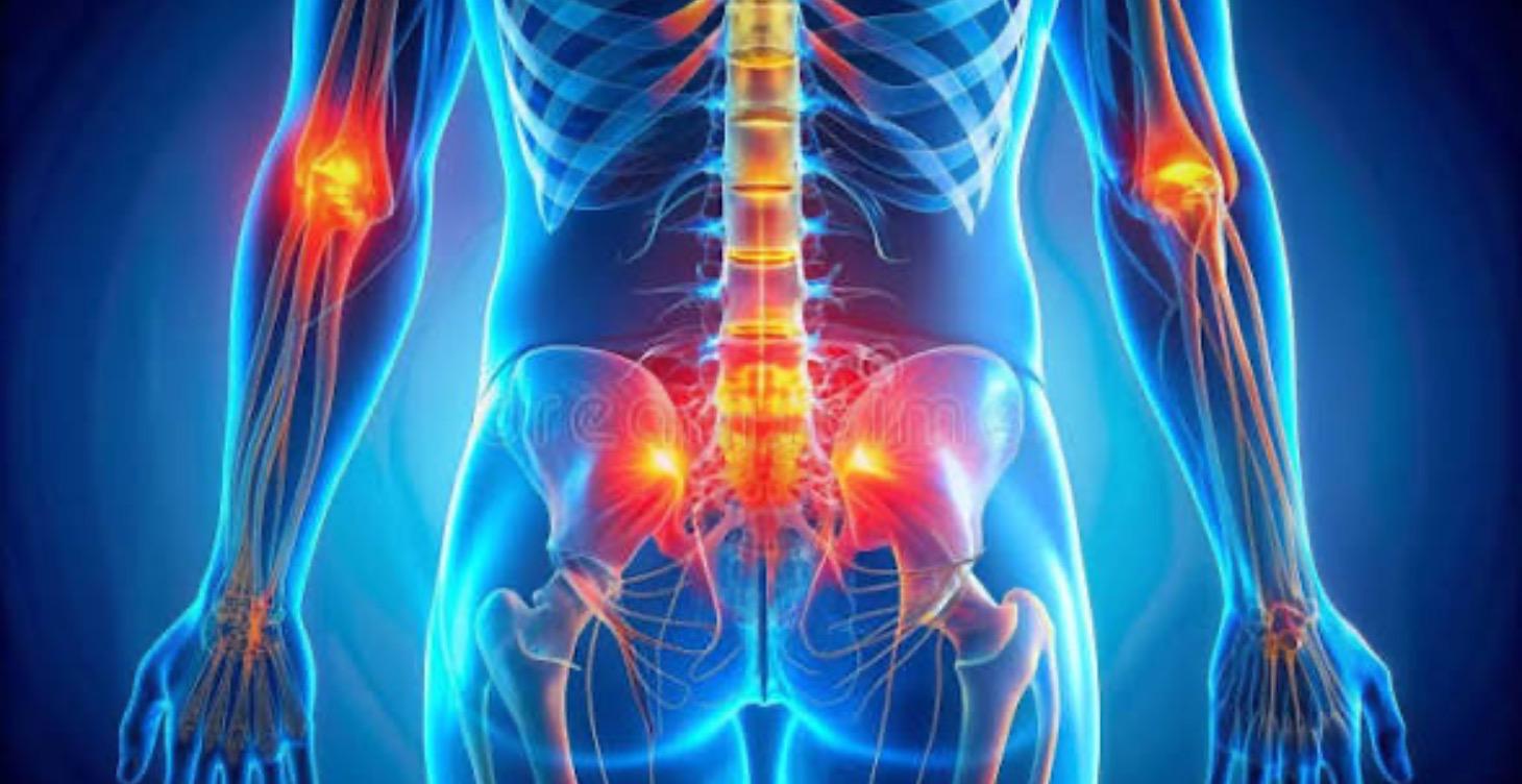 Sciatica or Back Pain?
