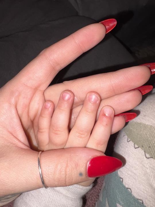 One year old cuticle looks irritated 