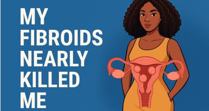 My Fibroids Nearly Killed Me