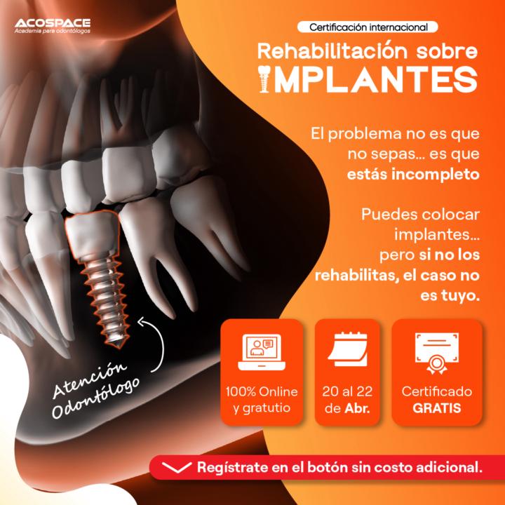 Certificación gratuita en Rehabilitación sobre Implantes