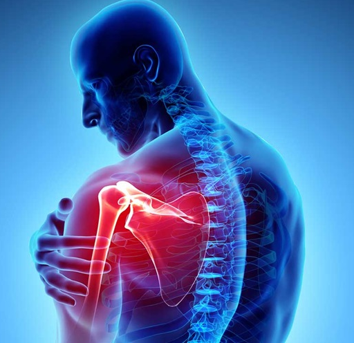 Why I love hanging for shoulder health