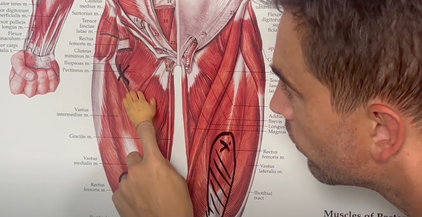 Trigger Point Self Assessments