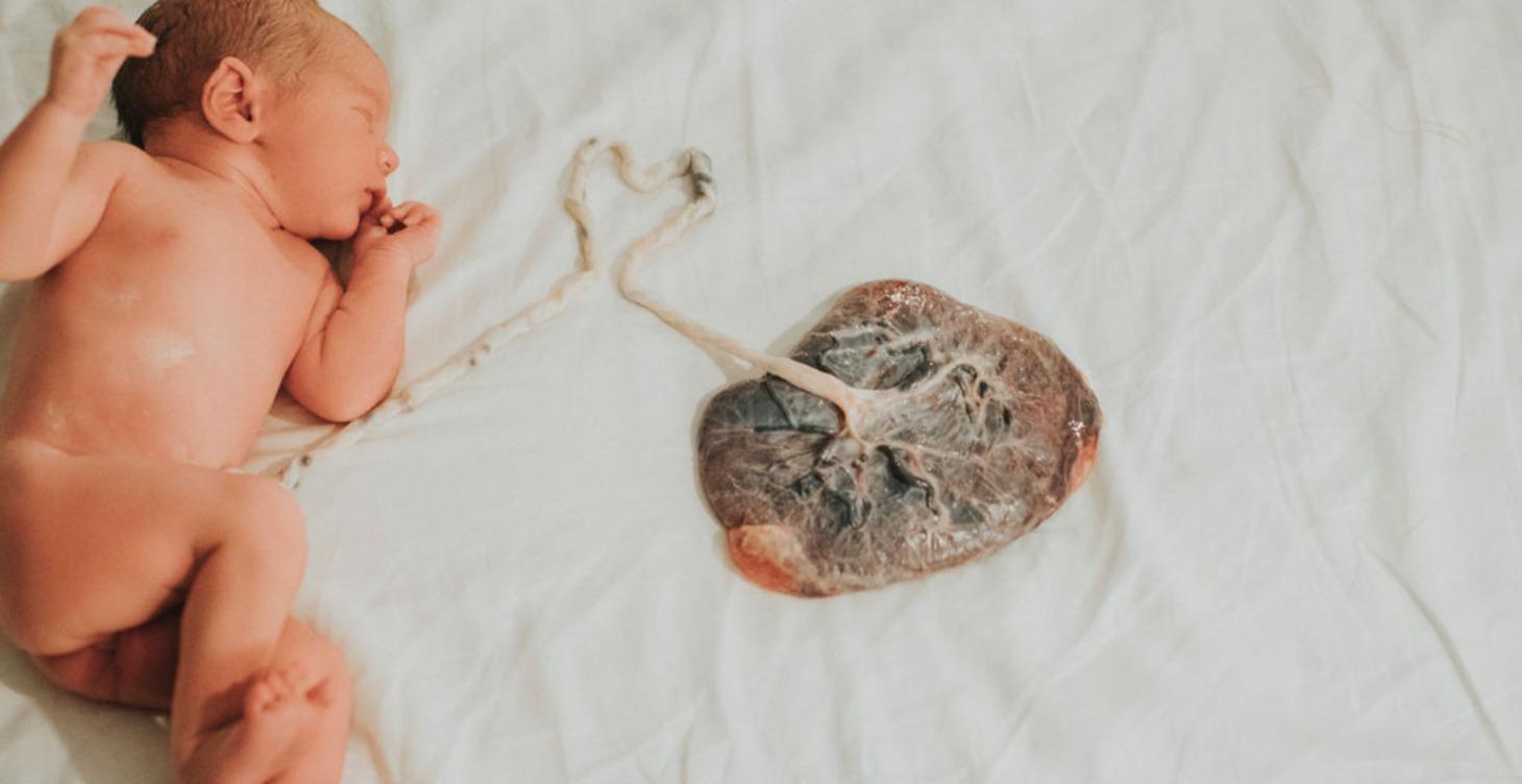 MODULE PREMIUM - PLACENTA ❤️