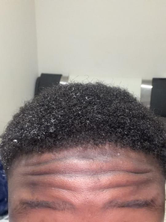 Hair looks bad even after moisture 