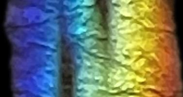 The Mindset Story Exchange