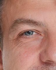Achim Wyschkon