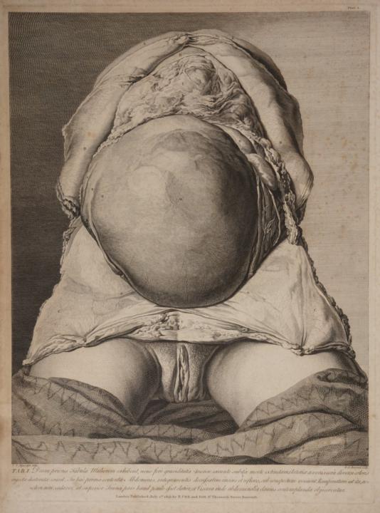The Anatomy of the Human Gravid Uterus Exhibited in Figures (1774) / The Anatomy of the Human Gravid Uterus Exhibited in Figures. 1774