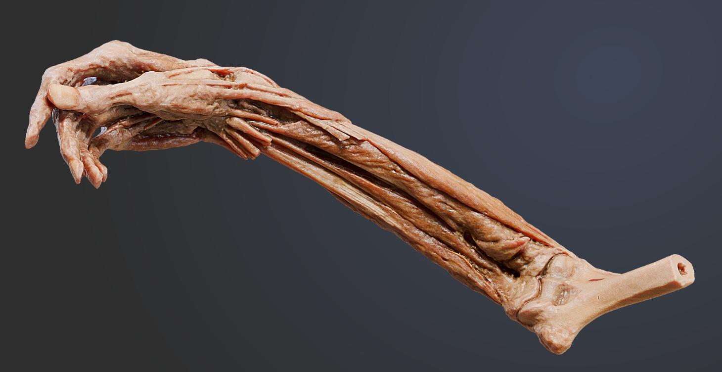 Basics of Arm Anatomy (1/3)