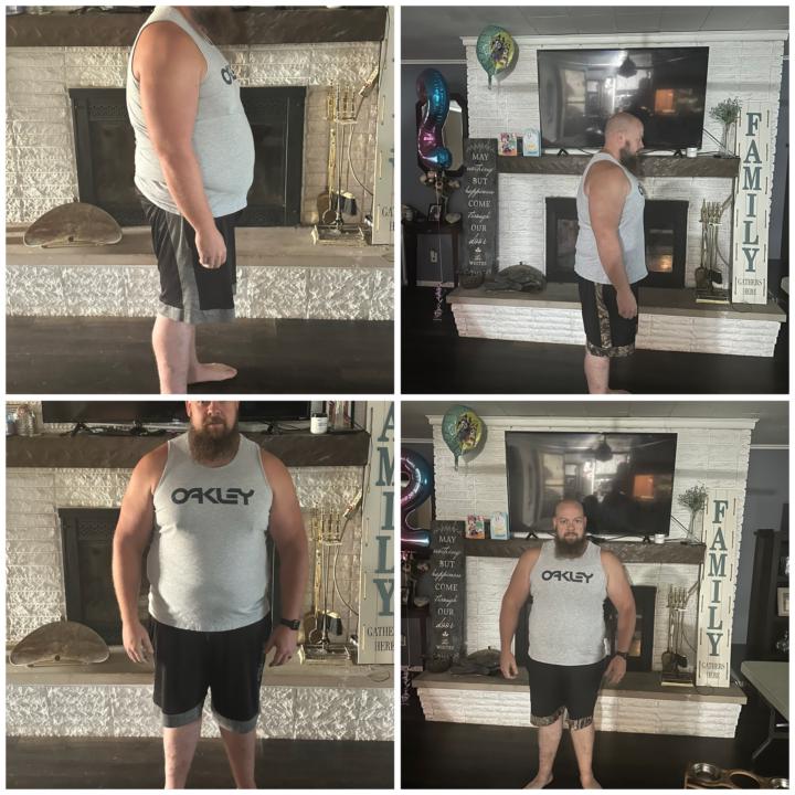 Before and after 