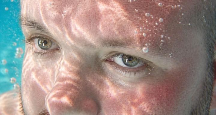 Anderman Syndrome