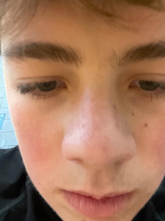 Kolter Becker