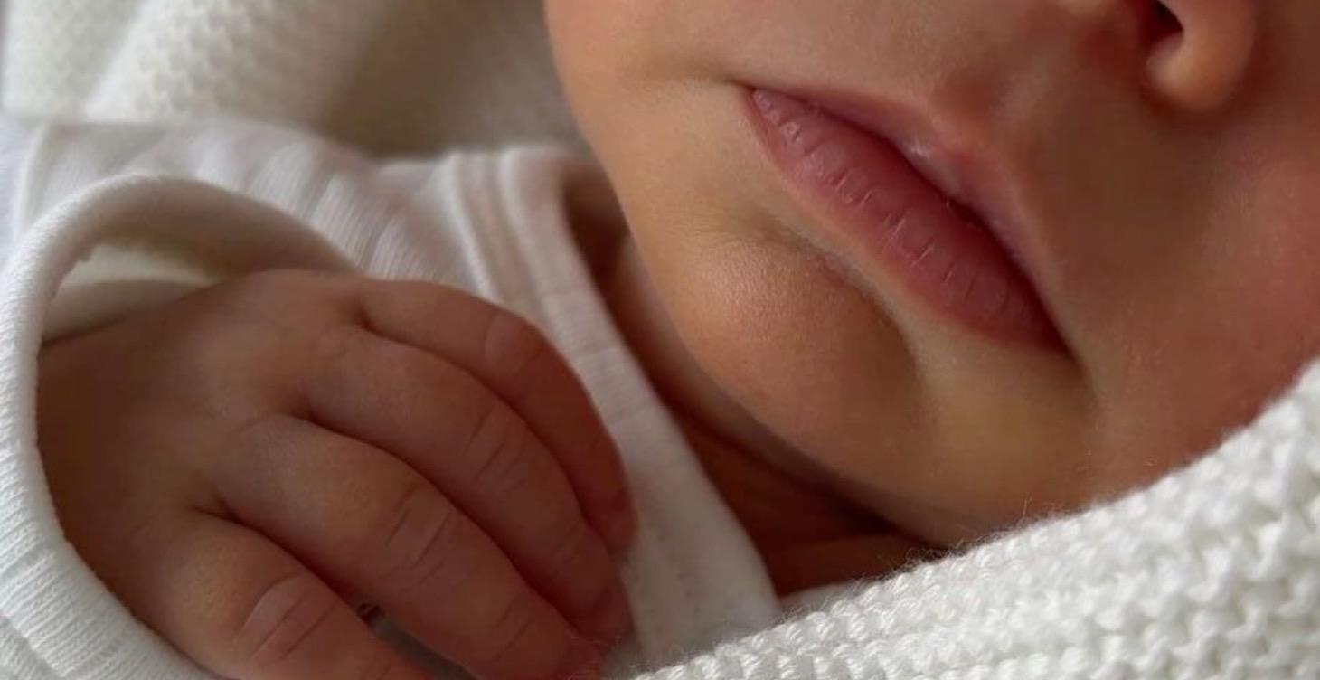 Why Tongue Tie Happens