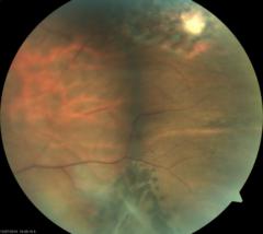 Inibrith von der Meden.