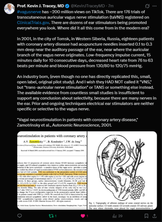 Why Electrical Ear Clip VNS May Not Live Up to the Hype...
