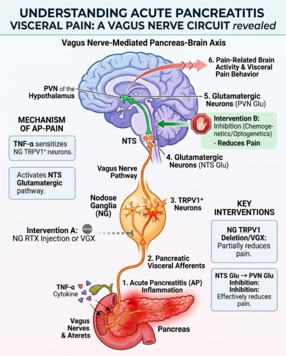 New Pancreas-Brain Axis Discovered To Treat Severe Pancreatitis Pain