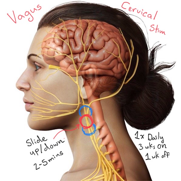 Overview of Methods of Ultrasound Stimulation of Vital Vagus Centers