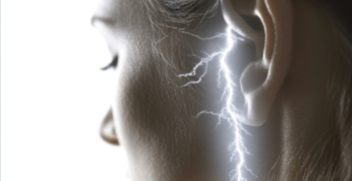 ⚡ Electrical VNS