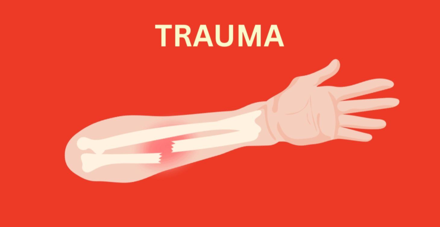 trauma