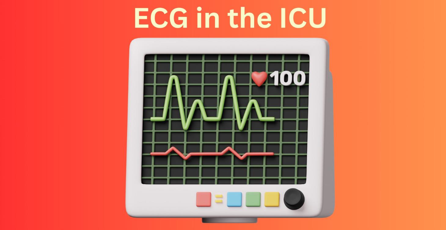 ECG in the ICU